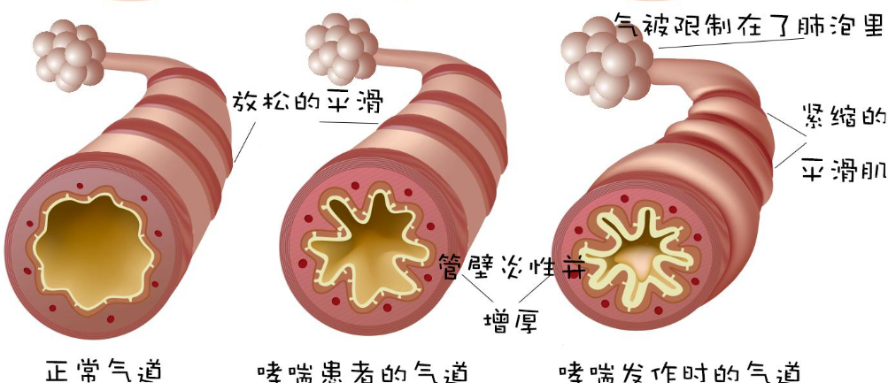 圖片 4